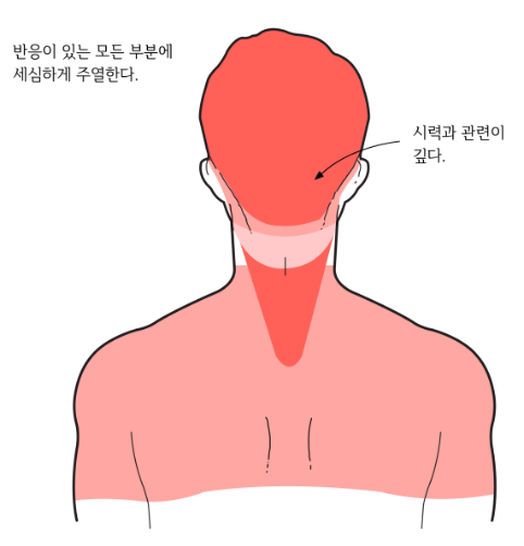 뇌암02