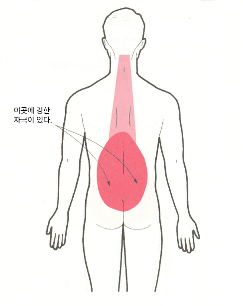폐암온열법02
