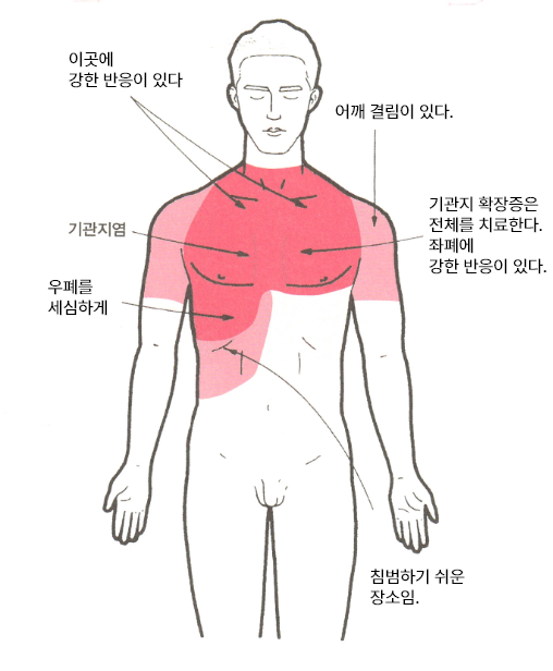 폐암온열법01
